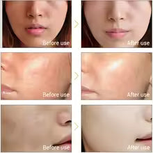 Multifunction Beauty Facial Massager